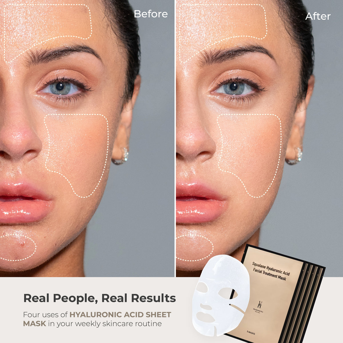 HYALUROIC ACID SHEET MASK