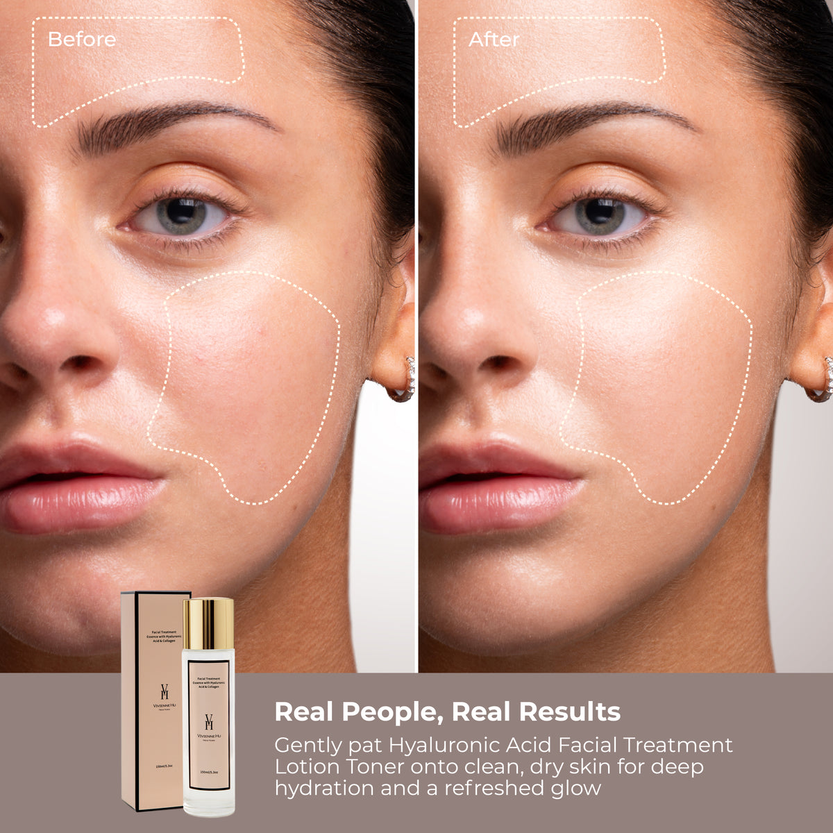 Facial Treatment Essence with Hyaluronic Acid & Collagen