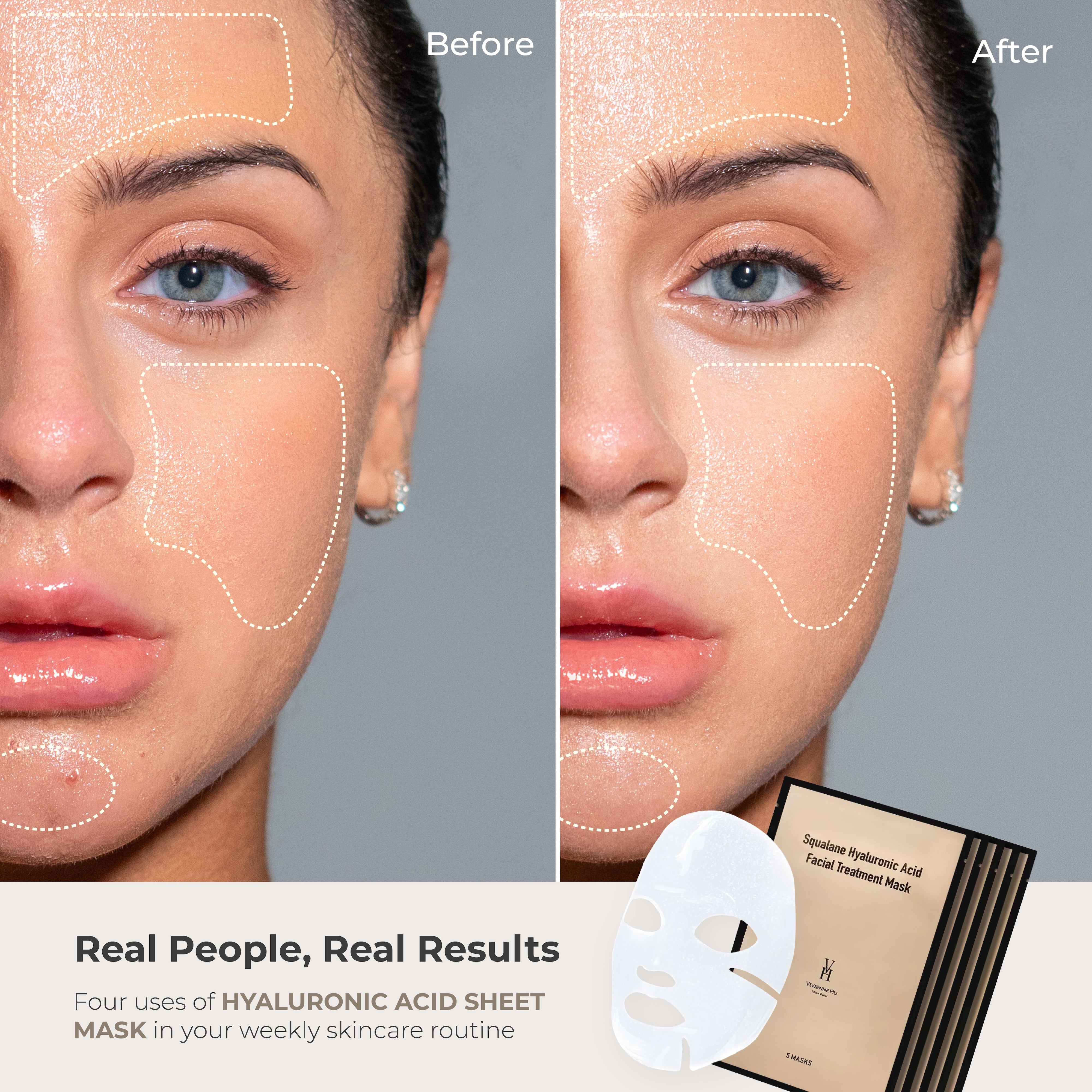 URU BEAUTY facial sheet mask プランエスクリニック URU BEAUTY